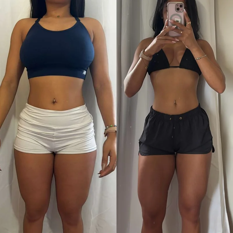 Comparação frontal de acompanhamento autorizada, antes e depois