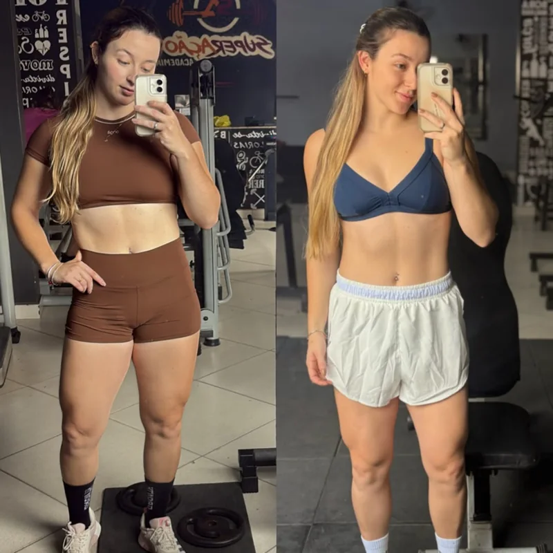 Comparação de acompanhamento autorizada, antes e depois