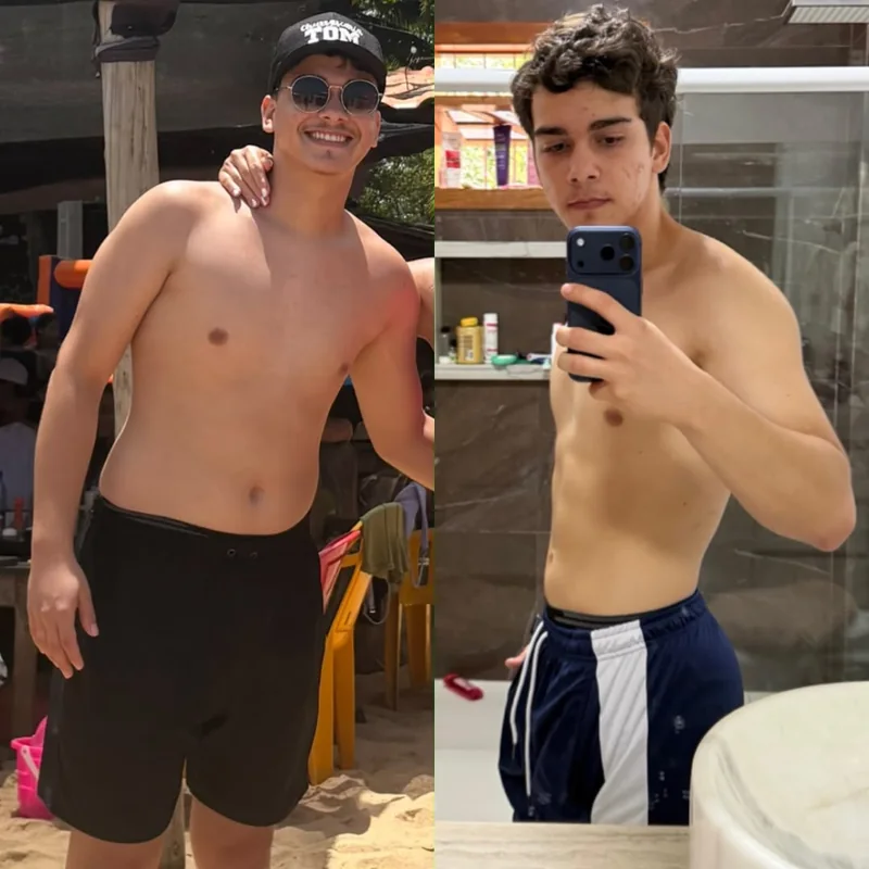 Comparação de acompanhamento autorizada, antes e depois